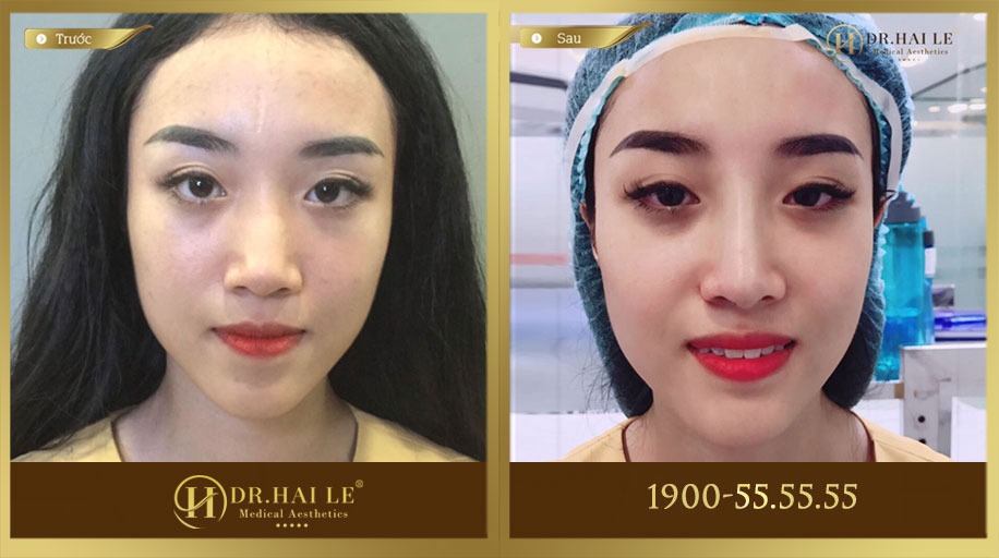 lỗi-khiến-quảng-cáo-Facebook-bị-từ-chối-18